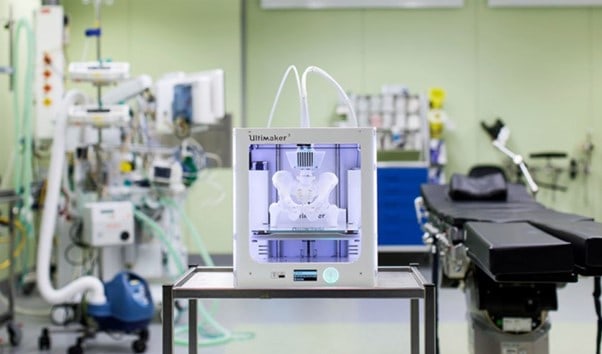 Patient-specific 3D-printed guides — millimeter-level navigation for pediatric bone-tumor surgery.